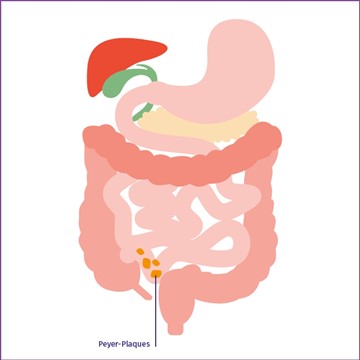 Abbildung Peyer Plaques IgAN Abbildung Peyer Plaques IgAN